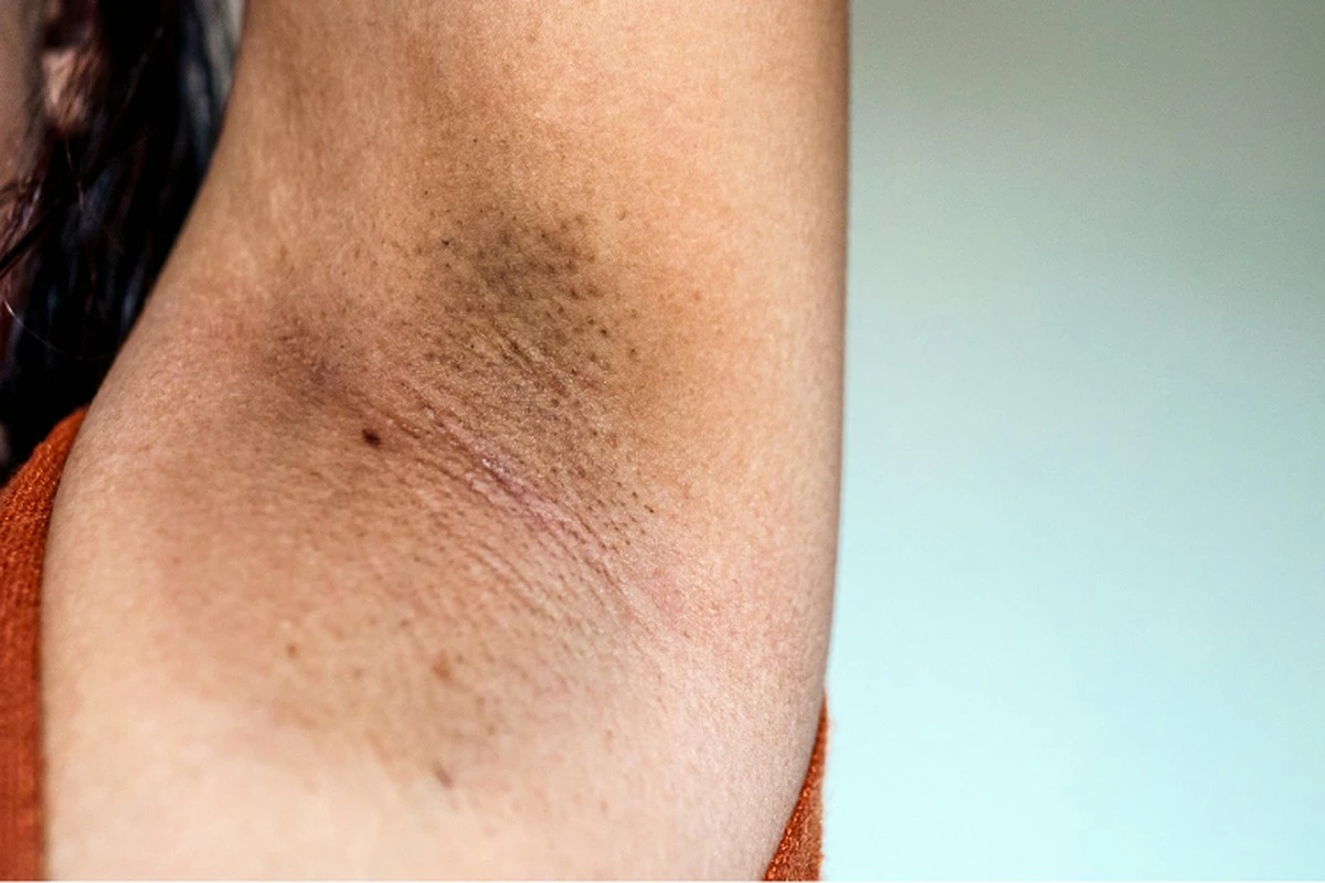 Jak usunąć twarde plamy pod pachami i odnowić jasne ubrania w kilka minut - image 1