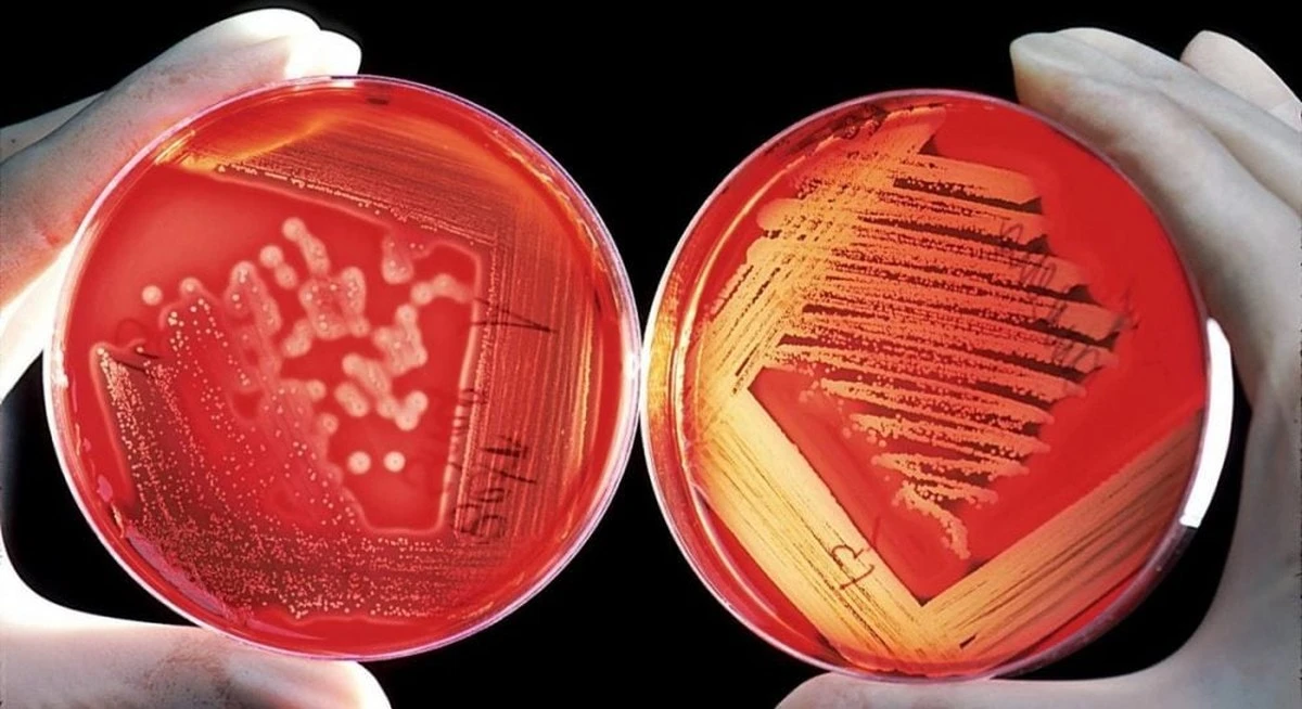 Bakterie z lodowej jaskini: Przetrwały 5000 lat i pokonały 10 antybiotyków
